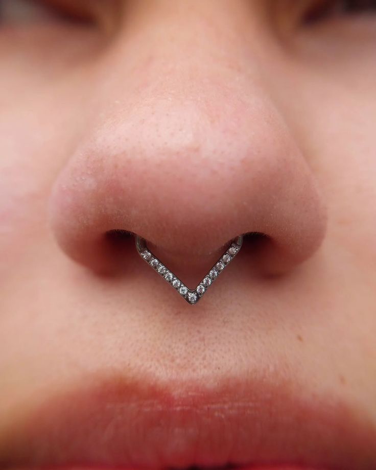 septum sofi