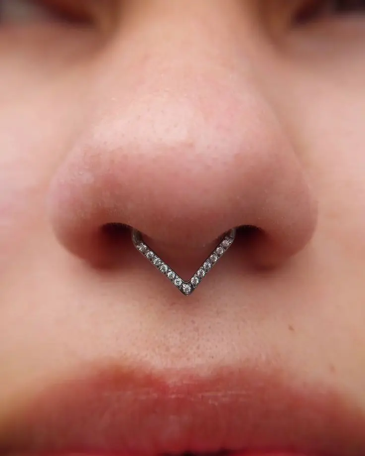 septum sofi
